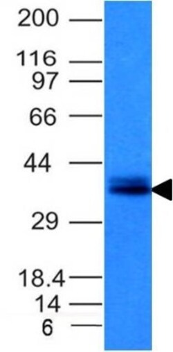 EpCAM/TROP1 Antibody (EGP40/1120) - (ECD), Novus Biologicals 0.2mg; Unlabeled:Antibodies,